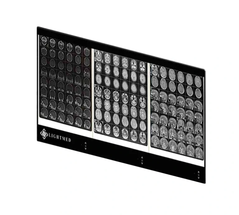 نگاتوسکوپ سه خانه دیجیتال
