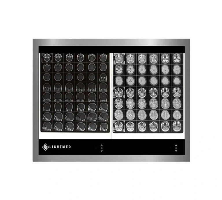 نگاتوسکوپ مخصوص اتاق عمل