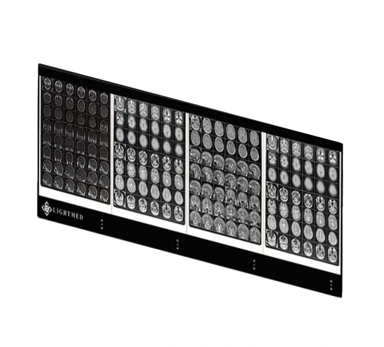 نگاتوسکوپ چهار خانه دیجیتال